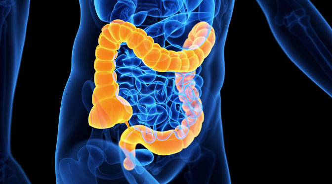 Morbo Di Crohn Si Può Morire
